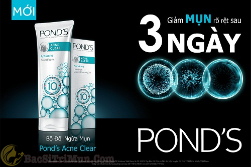 Sữa rửa mặt trị mụn Pond's