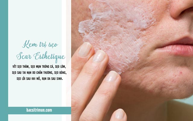 công dụng Kem trị sẹo Scar Esthetique