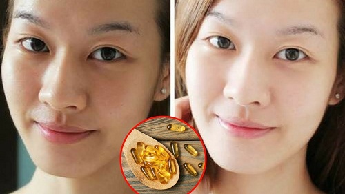 Vitamin A trị mụn, giảm vết thâm mụn hiệu quả