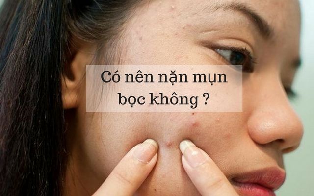 mụn bọc có nên nặn không