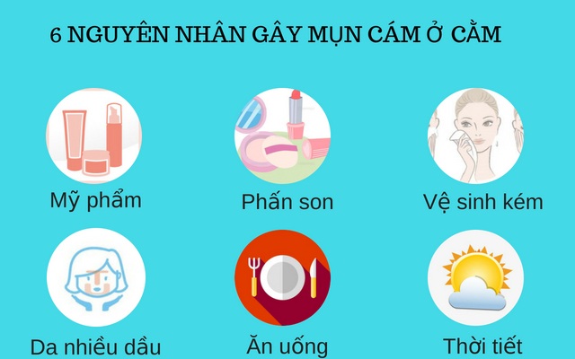 Nguyên nhân gây mụn cám ở cằm