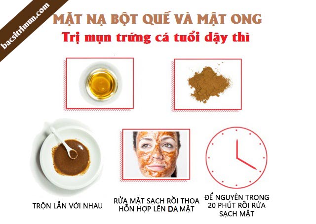 cách trị mụn dậy thì bằng bột quế và mật ong