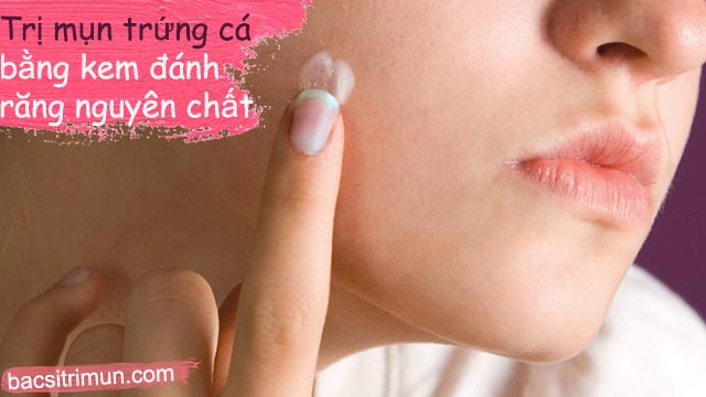 Cách trị mụn trứng cá bằng kem đánh răng nguyên chất