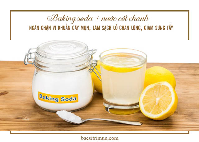 Cách trị mụn đầu đen bằng baking soda nước cốt chanh