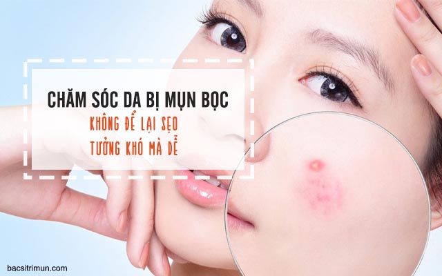 chăm sóc da mặt bị mụn bọc