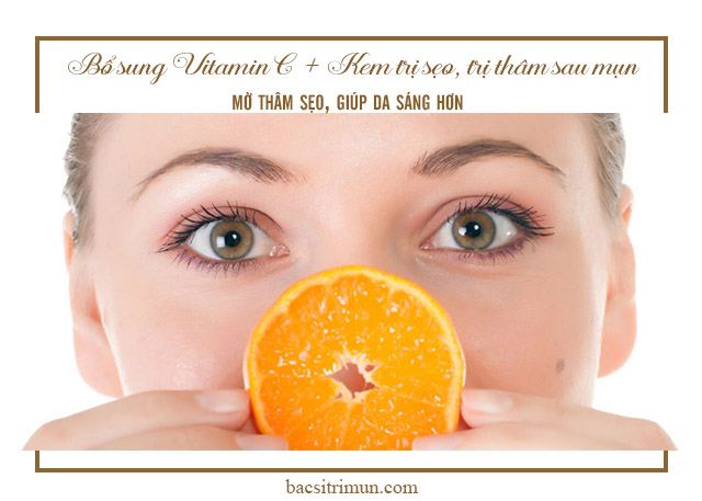 bổ sung vitamin C khi chăm sóc da sau mụn