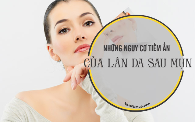 Đặc điểm của làn da sau mụn