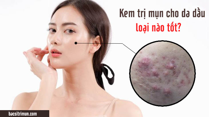 kem trị mụn cho da dầu