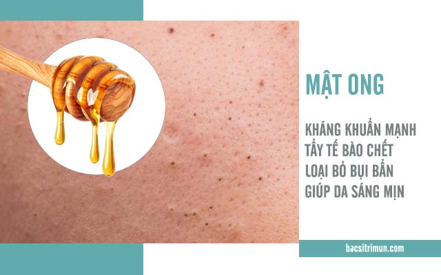 công dụng trị mụn của mật ong