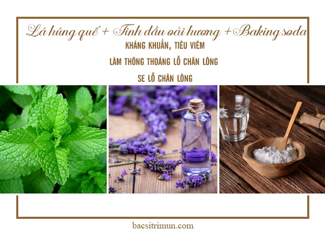 baking soda lá húng quế tinh dầu oải hương trị mụn đầu đen