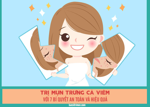 Cách trị mụn trứng cá viêm