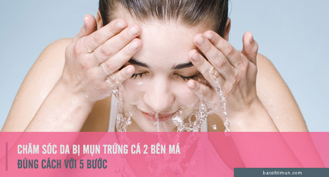 chăm sóc da để trị mụn trứng cá ở hai bên má