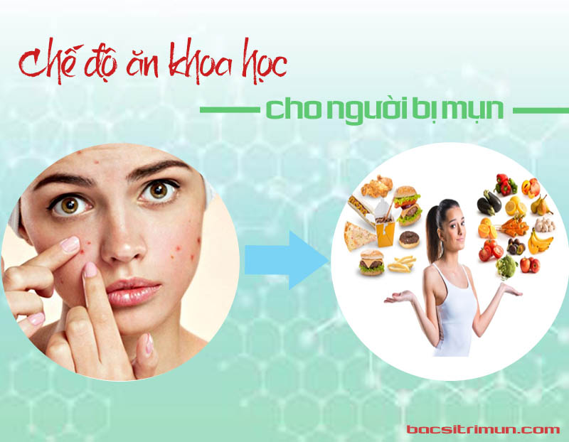 Chế độ ăn cho người bị mụn