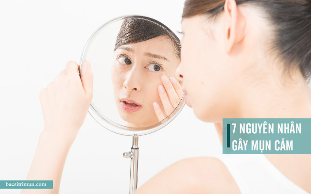 nguyên nhân gây mụn cám