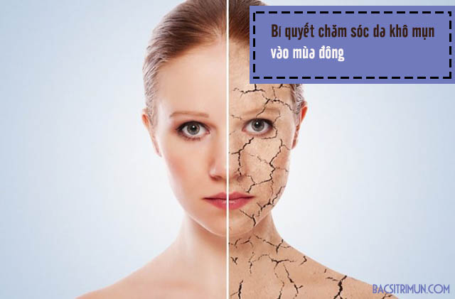 cách chăm sóc da khô mụn mùa đông