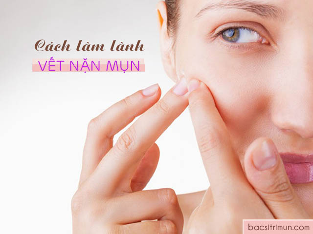 Cách làm lành vết nặn mụn