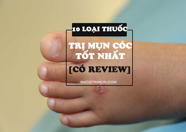 thuốc trị mụn cóc